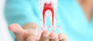 endodoncia clinica dental san juan alicante