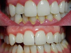 sarro clinica dental san juan de alicante
