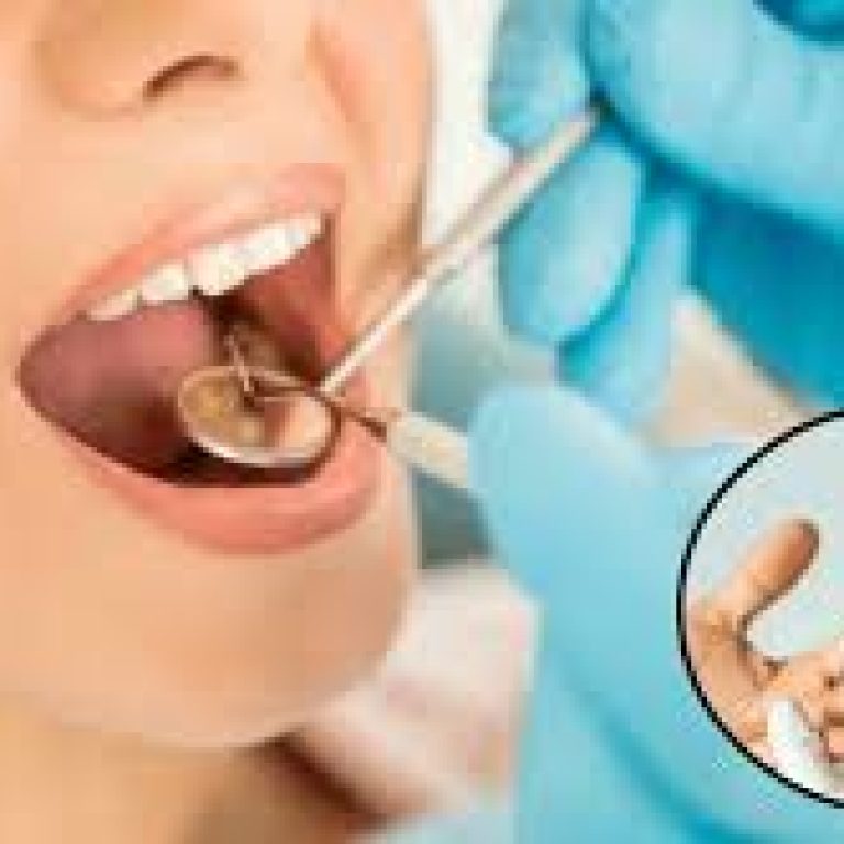 LA DIABETES Y SU RELACIÓN CON LA SALUD ORAL